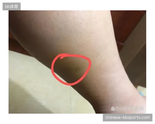 32岁的阿库尼亚因状态下滑和肌肉拉伤，在左后卫位置的竞争中输给了后起之秀